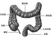 细菌性结肠炎