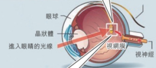 仿生人造眼