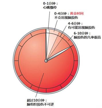 黄金四分钟（心源性猝死急救关键四分钟）