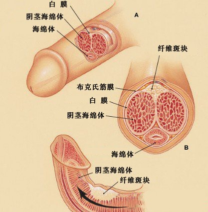 阴茎炎