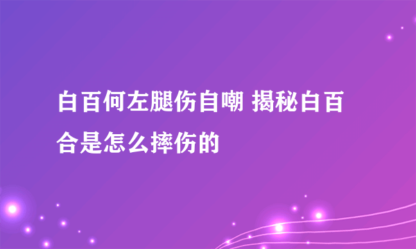 白百何左腿伤自嘲 揭秘白百合是怎么摔伤的