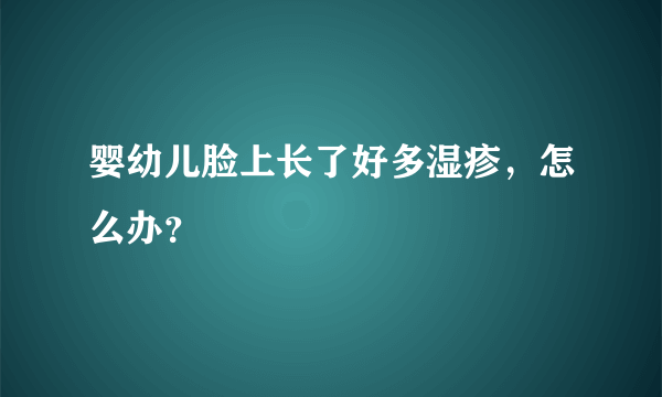 婴幼儿脸上长了好多湿疹，怎么办？