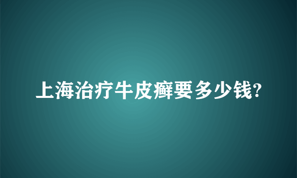 上海治疗牛皮癣要多少钱?