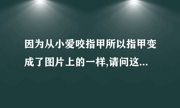 因为从小爱咬指甲所以指甲变成了图片上的一样,请问这样的指甲能做美甲吗??做什么类型的??