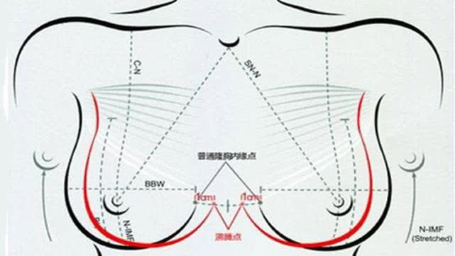 胎停的前兆，往往是出现哪几个表现一定要注意？