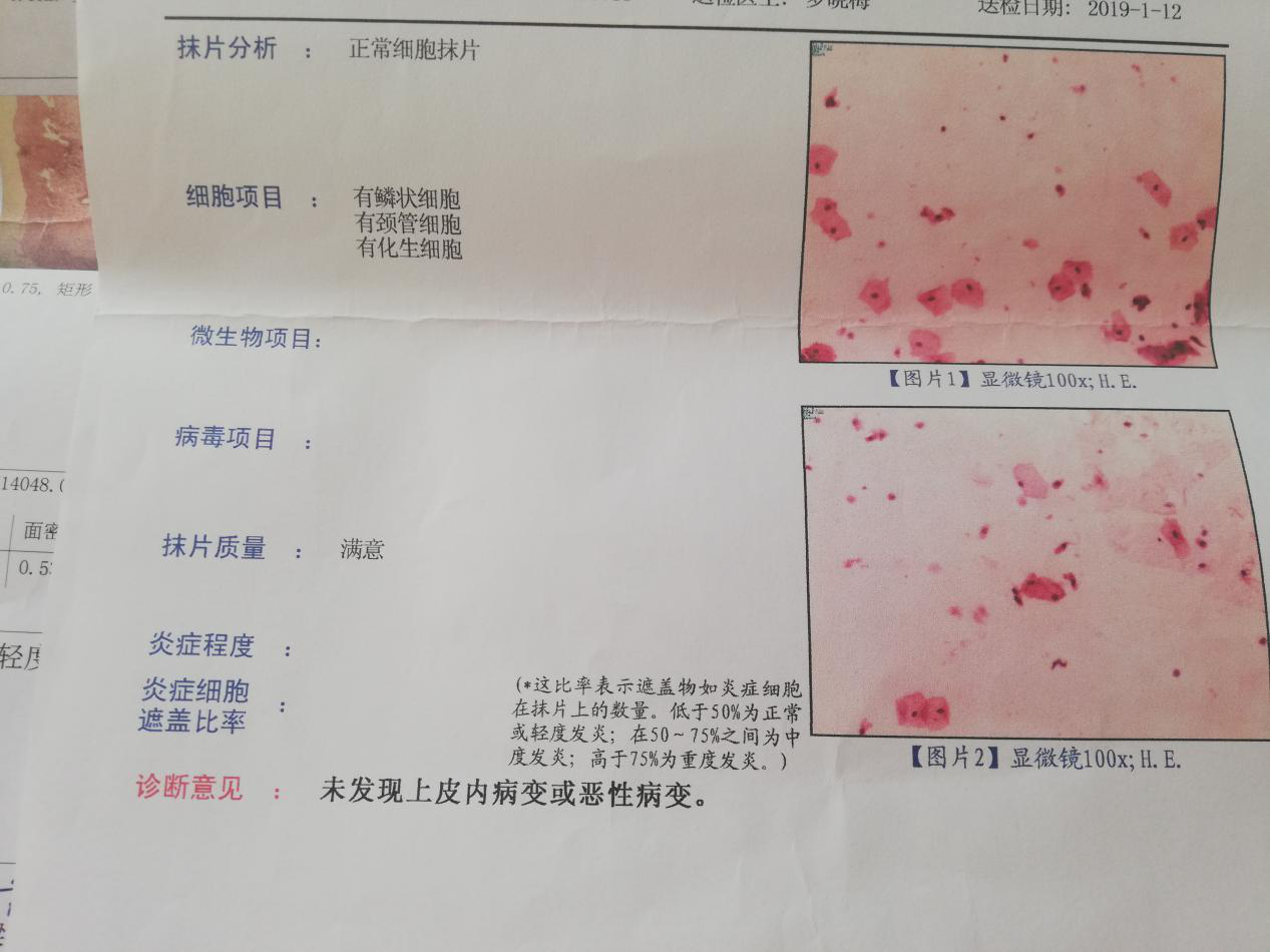 hpv16高危型阳性 这种疾病可以治愈吗