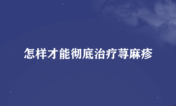 怎样才能彻底治疗荨麻疹