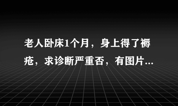 老人卧床1个月，身上得了褥疮，求诊断严重否，有图片，详情请进