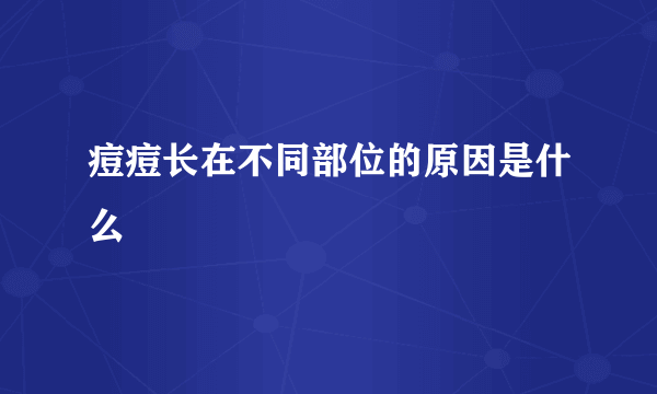 痘痘长在不同部位的原因是什么