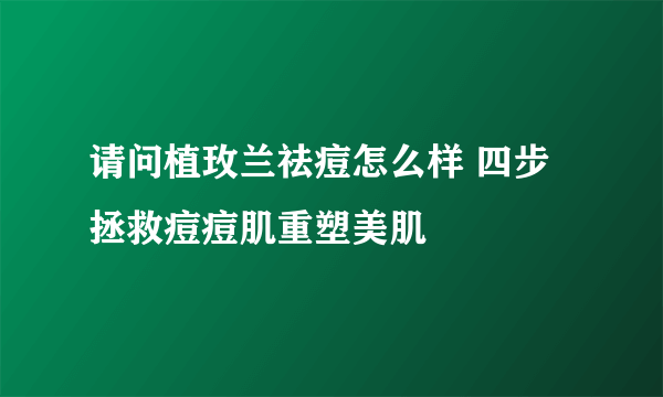 请问植玫兰祛痘怎么样 四步拯救痘痘肌重塑美肌