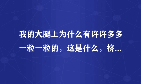 我的大腿上为什么有许许多多一粒一粒的。这是什么。挤一下就会有一根像寒毛。 怎么除掉他们