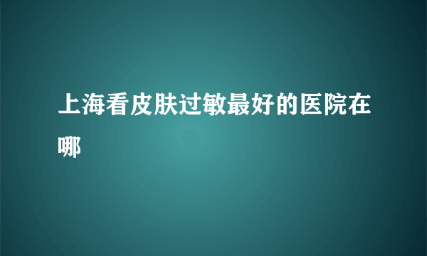 上海看皮肤过敏最好的医院在哪