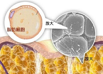 关于请问各位有谁知道哪一种减肥产品效果好