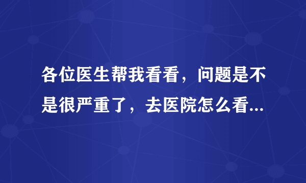 各位医生帮我看看，问题是不是很严重了，去医院怎么看才行。好急好怕