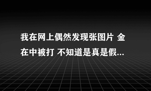 我在网上偶然发现张图片 金在中被打 不知道是真是假 他真的被打过么