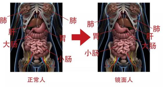 南宁一女子去看病，竟发现自己五脏六腑全部“反着长”，这会带来哪些危害？