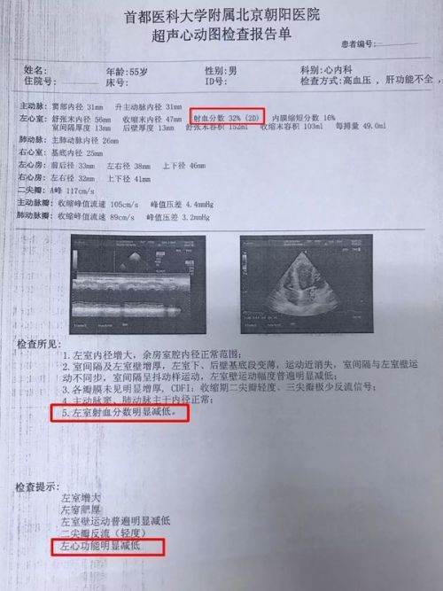 EF值是什么?