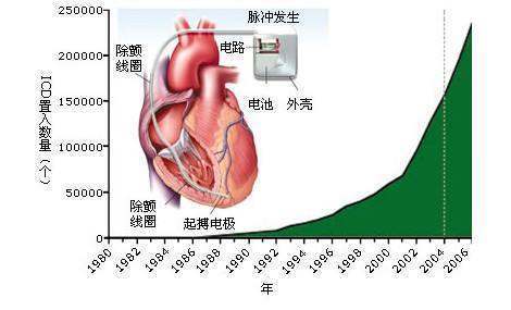 心功能1来自级、2级、3级、4级各代表什么？