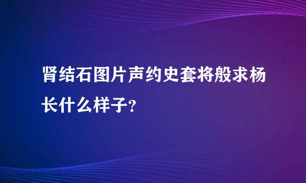 肾结石图片声约史套将般求杨长什么样子？