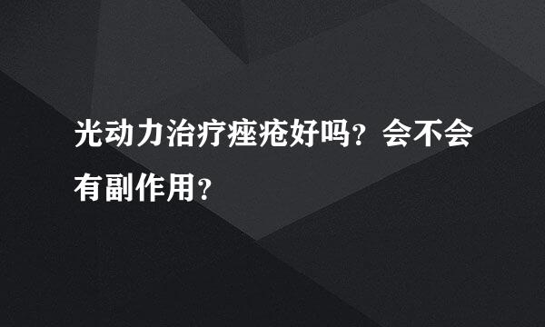 光动力治疗痤疮好吗？会不会有副作用？