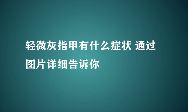 轻微灰指甲有什么症状 通过图片详细告诉你