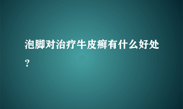 泡脚对治疗牛皮癣有什么好处？