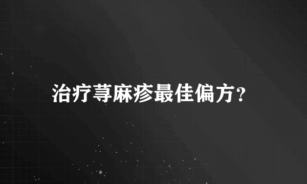 治疗荨麻疹最佳偏方？