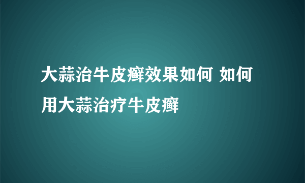 大蒜治牛皮癣效果如何 如何用大蒜治疗牛皮癣