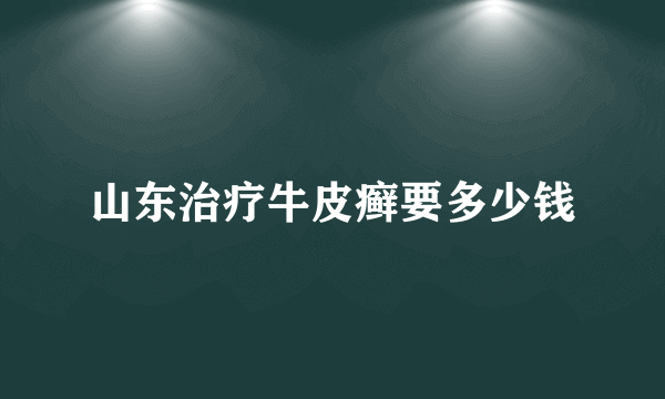 山东治疗牛皮癣要多少钱