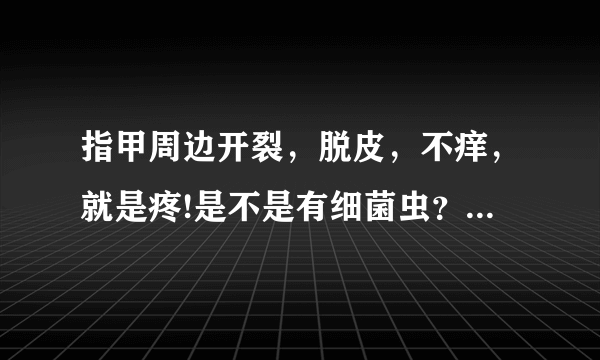 指甲周边开裂，脱皮，不痒，就是疼!是不是有细菌虫？要...